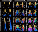 A comparative developmental study of the avian syrinx: Insights into the homology of the sound-producing muscles in birds